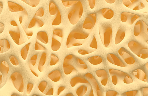 Bone Health (Osteoporosis) Home Test Kit UK Bone Health (Osteoporosis) Home Test Kit UK